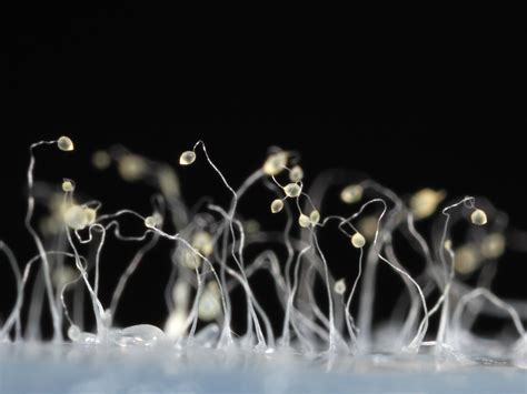  Dictyostelium Discoideum: A Single-Celled Slime Mold Embarking on Epic Journeys of Cooperation!