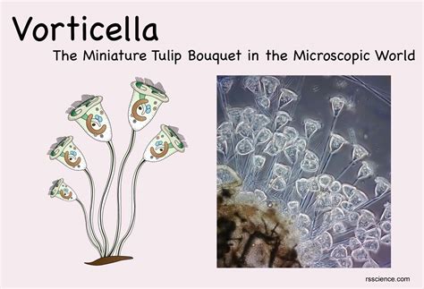 Vibrant Vorticella! A Microscopic Marvel That Uses Its Stalk Like a Tiny, Underwater Seesaw