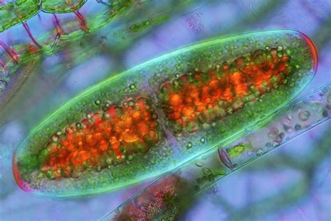  Yellow-Green Algae - A Microscopic Marvel That Photosynthesizes While Feasting on Other Organisms!